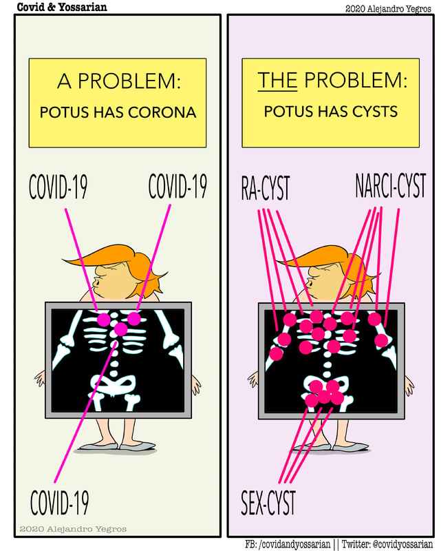 A Problem: POTUS has corona

COVID-19
COVID-19
COVID-19

The Problem: POTUS has cysts

RA-CYST
NARCI-CYST
SEX-CYST
